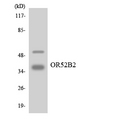 OR52B2 Antibody - Western blot analysis of the lysates from HepG2 cells using OR52B2 antibody.