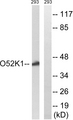 OR52K1 Antibody - Western blot analysis of lysates from 293 cells, using OR52K1 Antibody. The lane on the right is blocked with the synthesized peptide.