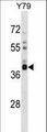 OR52L1 Antibody - OR52L1 Antibody western blot of Y79 cell line lysates (35 ug/lane). The OR52L1 antibody detected the OR52L1 protein (arrow).