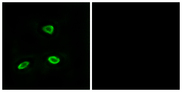 OR52N1 Antibody - Immunofluorescence analysis of LOVO cells, using OR52N1 Antibody. The picture on the right is blocked with the synthesized peptide.