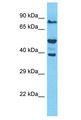 OR52W1 Antibody - OR52W1 antibody Western Blot of Jurkat. Antibody dilution: 1 ug/ml.  This image was taken for the unconjugated form of this product. Other forms have not been tested.