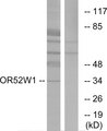 OR52W1 Antibody - Western blot analysis of lysates from HeLa cells, using OR52W1 Antibody. The lane on the right is blocked with the synthesized peptide.