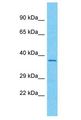 OR56A3 Antibody - OR56A3 antibody Western Blot of RPMI-8226. Antibody dilution: 1 ug/ml.  This image was taken for the unconjugated form of this product. Other forms have not been tested.