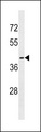 OR56B1 Antibody - OR56B1 Antibody western blot of MCF-7 cell line lysates (35 ug/lane). The OR56B1 Antibody detected the OR56B1 protein (arrow).