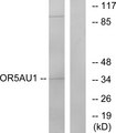 OR5AU1 Antibody - Western blot analysis of lysates from Jurkat cells, using OR5AU1 Antibody. The lane on the right is blocked with the synthesized peptide.