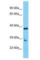 OR5AU1 Antibody - OR5AU1 antibody Western Blot of RPMI-8226. Antibody dilution: 1 ug/ml.  This image was taken for the unconjugated form of this product. Other forms have not been tested.