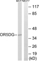 OR5D16 Antibody - Western blot analysis of lysates from MCF-7 cells, using OR5D16 Antibody. The lane on the right is blocked with the synthesized peptide.