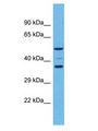 OR5K4 Antibody - OR5K4 antibody Western Blot of Fetal Kidney. Antibody dilution: 1 ug/ml.  This image was taken for the unconjugated form of this product. Other forms have not been tested.
