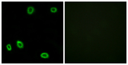 OR5L1+2 Antibody - Immunofluorescence analysis of HUVEC cells, using OR5L1/2 Antibody. The picture on the right is blocked with the synthesized peptide.