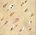 OR5L2 Antibody - OR5L2 antibody immunohistochemistry of formalin-fixed and paraffin-embedded human brain tissue followed by peroxidase-conjugated secondary antibody and DAB staining.