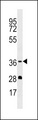 OR5M1 Antibody - OR5M1 Antibody western blot of MDA-MB453 cell line lysates (35 ug/lane). The OR5M1 antibody detected the OR5M1 protein (arrow).