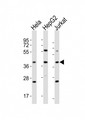 OR5M9 Antibody - All lanes : Anti-OR5M9 Antibody at 1:4000 dilution Lane 1: HeLa whole cell lysates Lane 2: HepG2 whole cell lysates Lane 3: Jurkat whole cell lysates Lysates/proteins at 20 ug per lane. Secondary Goat Anti-Rabbit IgG, (H+L), Peroxidase conjugated at 1/10000 dilution Predicted band size : 35 kDa Blocking/Dilution buffer: 5% NFDM/TBST.