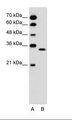 OR5T2 Antibody - A: Marker, B: Jurkat Cell Lysate.  This image was taken for the unconjugated form of this product. Other forms have not been tested.