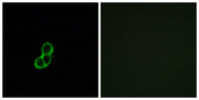 OR5T3 Antibody - Immunofluorescence analysis of MCF7 cells, using OR5T3 Antibody. The picture on the right is blocked with the synthesized peptide.