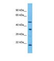 OR5T3 Antibody - Western blot of Human Fetal Liver. OR5T3 antibody dilution 1.0 ug/ml.  This image was taken for the unconjugated form of this product. Other forms have not been tested.