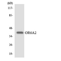 OR6A2 Antibody - Western blot analysis of the lysates from HeLa cells using OR6A2 antibody.