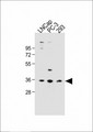 OR6C3 Antibody - All lanes: Anti-OR6C3 Antibody (Center) at 1:1000 dilution Lane 1: LNCap whole cell lysate Lane 2: PC-3 whole cell lysate Lane 3: 293 whole cell lysate Lysates/proteins at 20 µg per lane. Secondary Goat Anti-Rabbit IgG, (H+L), Peroxidase conjugated at 1/10000 dilution. Predicted band size: 36 kDa Blocking/Dilution buffer: 5% NFDM/TBST.