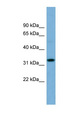 OR6C68 Antibody - OR6C68 antibody Western blot of OVCAR-3 cell lysate. This image was taken for the unconjugated form of this product. Other forms have not been tested.