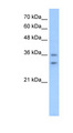OR6C70 Antibody - OR6C70 antibody ARP44511_T100-NP_001005499-OR6C70(olfactory receptor, family 6, subfamily C, member 70) Antibody Western blot of HepG2 cell lysate.  This image was taken for the unconjugated form of this product. Other forms have not been tested.