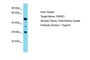 OR6Q1 Antibody -  This image was taken for the unconjugated form of this product. Other forms have not been tested.