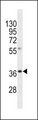 OR8A1 Antibody - OR8A1 Antibody western blot of human placenta tissue lysates (35 ug/lane). The OR8A1 antibody detected the OR8A1 protein (arrow).