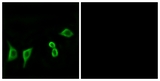 OR8G2 Antibody - Immunofluorescence of LOVO cells, using OR8G2 Antibody. The picture on the right is treated with the synthesized peptide.