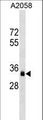 OR8J3 Antibody - OR8J3 Antibody western blot of A2058 cell line lysates (35 ug/lane). The OR8J3 antibody detected the OR8J3 protein (arrow).