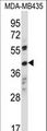 OR8K1 Antibody - OR8K1 Antibody western blot of MDA-MB435 cell line lysates (35 ug/lane). The OR8K1 antibody detected the OR8K1 protein (arrow).