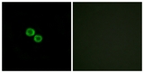 OR8K3 Antibody - Immunofluorescence of HUVEC cells, using OR8K3 Antibody. The sample on the right was incubated with synthetic peptide.