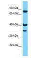 OR8U8 Antibody - OR8U8 antibody Western Blot of 721_B. Antibody dilution: 1 ug/ml.  This image was taken for the unconjugated form of this product. Other forms have not been tested.