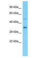 OR8U9 Antibody - OR8U9 antibody Western Blot of HeLa. Antibody dilution: 1 ug/ml.  This image was taken for the unconjugated form of this product. Other forms have not been tested.