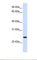 ORC6 / ORC6L Antibody - Fetal liver lysate. Antibody concentration: 1.0 ug/ml. Gel concentration: 12%.  This image was taken for the unconjugated form of this product. Other forms have not been tested.