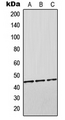 ORM2 / Orosomucoid 2 Antibody - Western blot analysis of Orosomucoid 2 expression in HEK293T (A); SP2/0 (B); H9C2 (C) whole cell lysates.