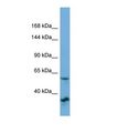 OSBP2 Antibody - Western blot of Human OVCAR-3. OSBP2 antibody dilution 1.0 ug/ml.  This image was taken for the unconjugated form of this product. Other forms have not been tested.