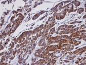 OSBPL1A / ORP1 Antibody - IHC of paraffin-embedded A549 xenograft using ORP1 antibody at 1:100 dilution.