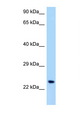OSCAR Antibody - OSCAR antibody Western blot of Jurkat Cell lysate. Antibody concentration 1 ug/ml.  This image was taken for the unconjugated form of this product. Other forms have not been tested.