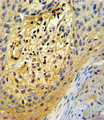 Osteonectin / SPARC Antibody - Formalin-fixed and paraffin-embedded human skin tissue reacted with SPARC Antibody , which was peroxidase-conjugated to the secondary antibody, followed by DAB staining. This data demonstrates the use of this antibody for immunohistochemistry; clinical relevance has not been evaluated.