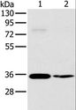 OTUB1 / OTU1 Antibody - Western blot analysis of 293T and skov3 cell, using OTUB1 Polyclonal Antibody at dilution of 1:570.