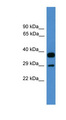 OTUB2 Antibody - OTUB2 antibody Western blot of Fetal Brain lysate. This image was taken for the unconjugated form of this product. Other forms have not been tested.