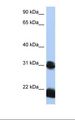 OTX1 Antibody - HepG2 cell lysate. Antibody concentration: 1.0 ug/ml. Gel concentration: 12%.  This image was taken for the unconjugated form of this product. Other forms have not been tested.
