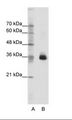 OTX1 Antibody - A: Marker, B: Jurkat Cell Lysate.  This image was taken for the unconjugated form of this product. Other forms have not been tested.