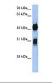 OTX1 Antibody - Transfected 293T cell lysate. Antibody concentration: 1.0 ug/ml. Gel concentration: 12%.  This image was taken for the unconjugated form of this product. Other forms have not been tested.