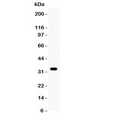OTX2 Antibody - Western blot testing of Otx2 antibody and COLO320 lysate. Predicted/observed size ~32KD