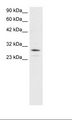 OTX2 Antibody - Jurkat Cell Lysate.  This image was taken for the unconjugated form of this product. Other forms have not been tested.