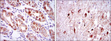 OTX2 Antibody - IHC of paraffin-embedded stomach tissues (left) and brain tissues (right) using OTX2 mouse monoclonal antibody with DAB staining.