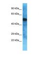 OVCH2 Antibody - Western blot of Human Jurkat. OVCH2 antibody dilution 1.0 ug/ml.  This image was taken for the unconjugated form of this product. Other forms have not been tested.