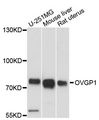 OVGP1 / Oviductin Antibody - Western blot analysis of extracts of various cell lines, using OVGP1 antibody at 1:3000 dilution. The secondary antibody used was an HRP Goat Anti-Rabbit IgG (H+L) at 1:10000 dilution. Lysates were loaded 25ug per lane and 3% nonfat dry milk in TBST was used for blocking. An ECL Kit was used for detection and the exposure time was 15s.