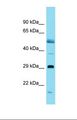OVOL1 Antibody - Western blot of Rat Pancreas. Ovol1 antibody dilution 1.0 ug/ml.  This image was taken for the unconjugated form of this product. Other forms have not been tested.