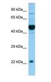 OX1R / Orexin Receptor 1 Antibody - OX1R / Orexin Receptor 1 antibody Western Blot of Fetal Brain.  This image was taken for the unconjugated form of this product. Other forms have not been tested.