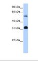 OXCT1 Antibody - Hela cell lysate. Antibody concentration: 0.5 ug/ml. Gel concentration: 12%.  This image was taken for the unconjugated form of this product. Other forms have not been tested.